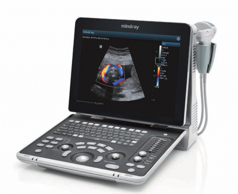 Portable Ultrasound (Z50) 