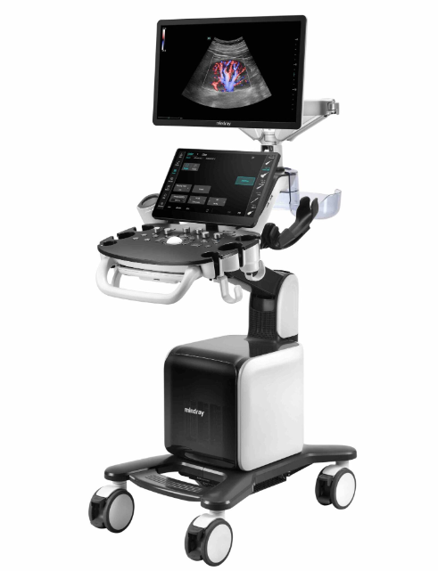 ULTRASOUND MACHINE CONSONA N9